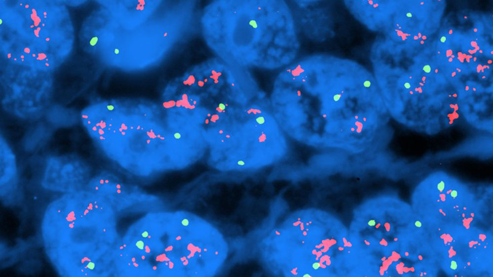 Molecular Genetics Pathology