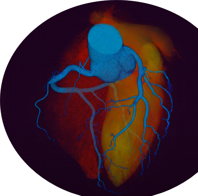 colorful rendering of a CT scan of the heart